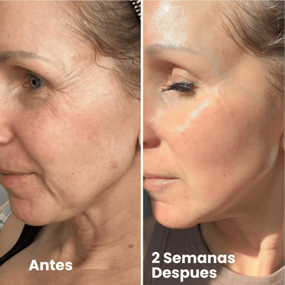 Velisse® Retinal Shot - Adiós Arrugas