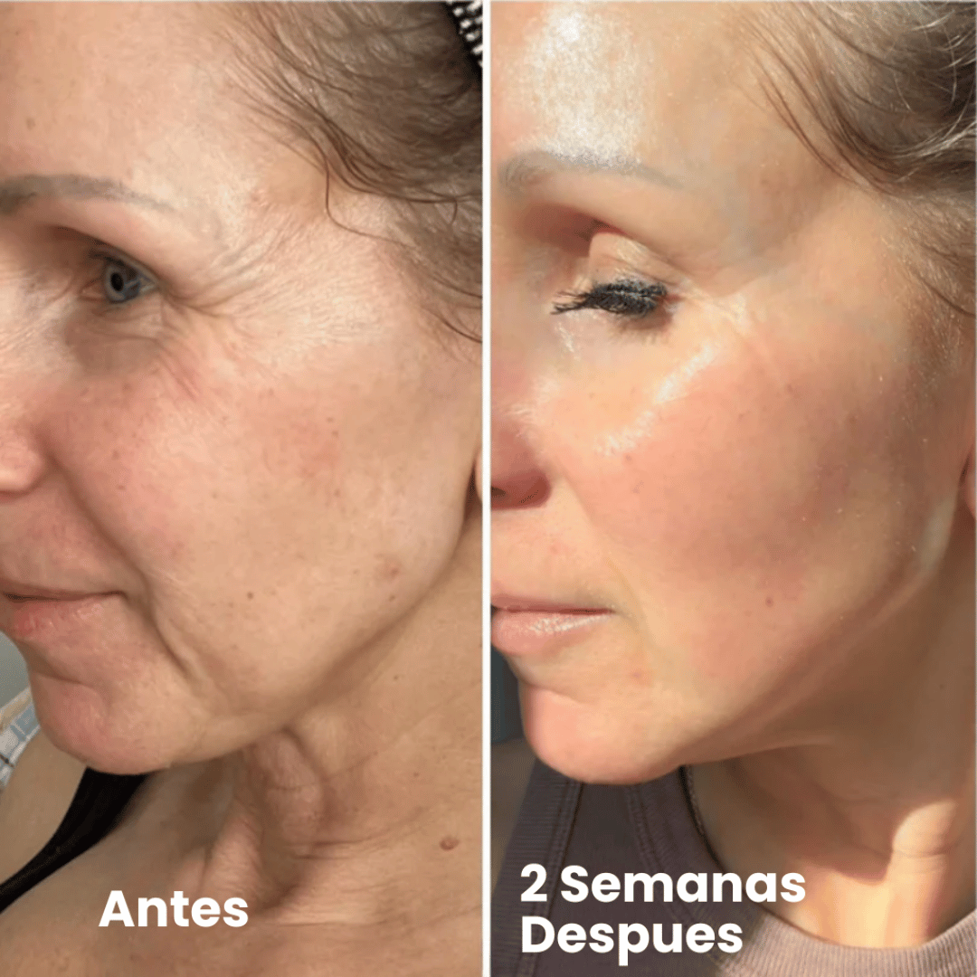 Trío Adiós Arrugas Coreano + Regalo Gratis