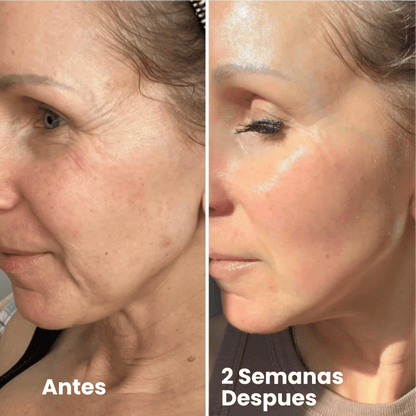 Trío Adiós Arrugas Coreano + Regalo Gratis