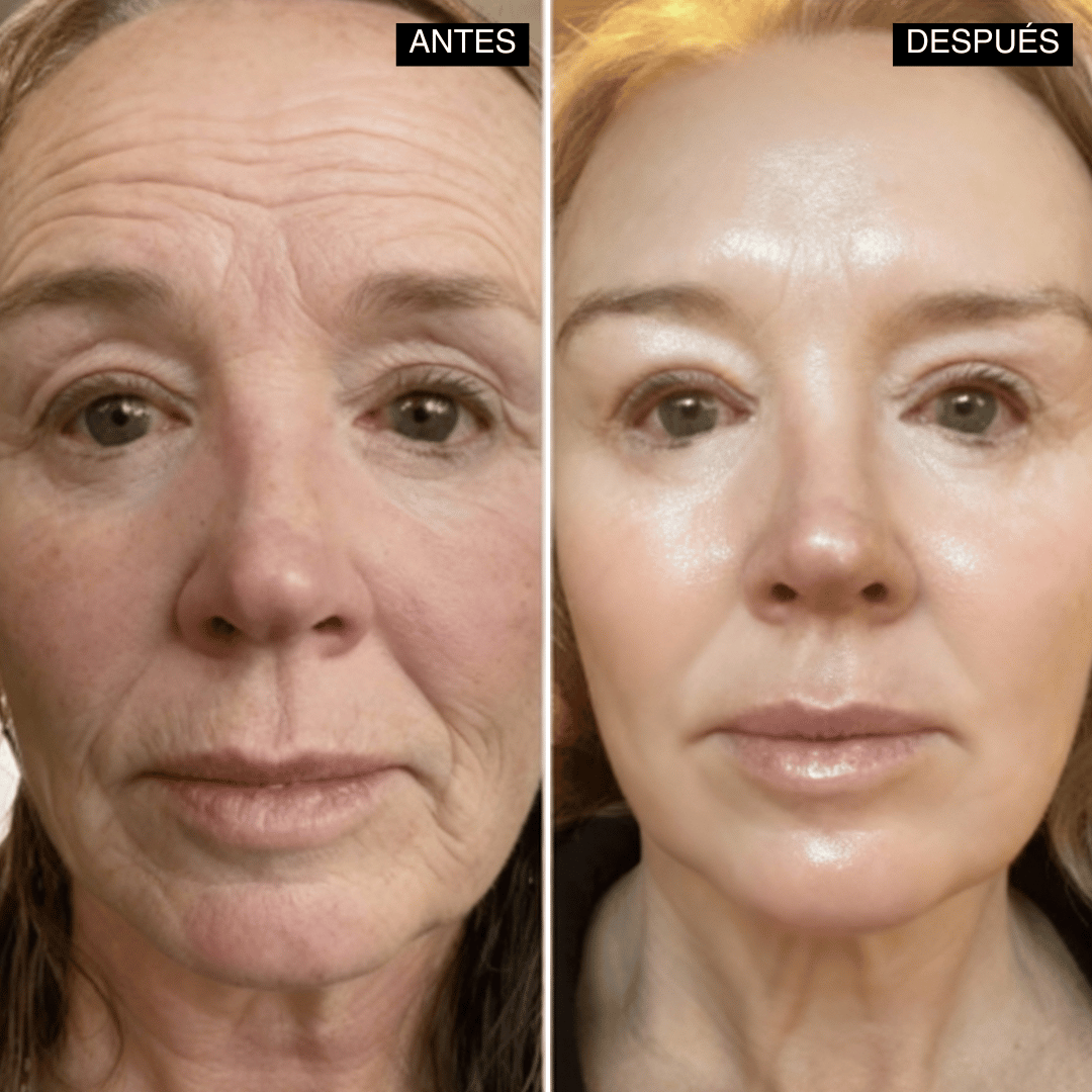 Velisse® Retinal Shot - Adiós Arrugas