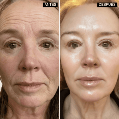 Velisse® Retinal Shot - Adiós Arrugas