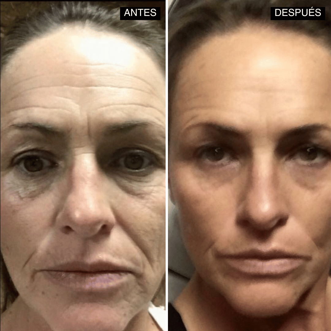 Velisse® Retinal Shot - Adiós Arrugas