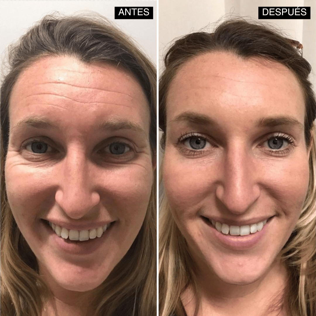 Velisse® Retinal Shot - Adiós Arrugas