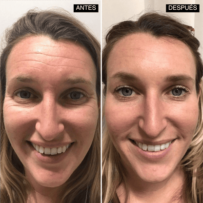 Velisse® Retinal Shot - Adiós Arrugas