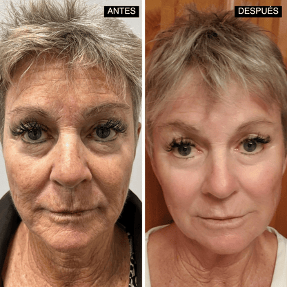 Velisse® Retinal Shot - Adiós Arrugas