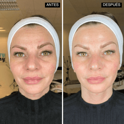 Velisse® Retinal Shot - Adiós Arrugas