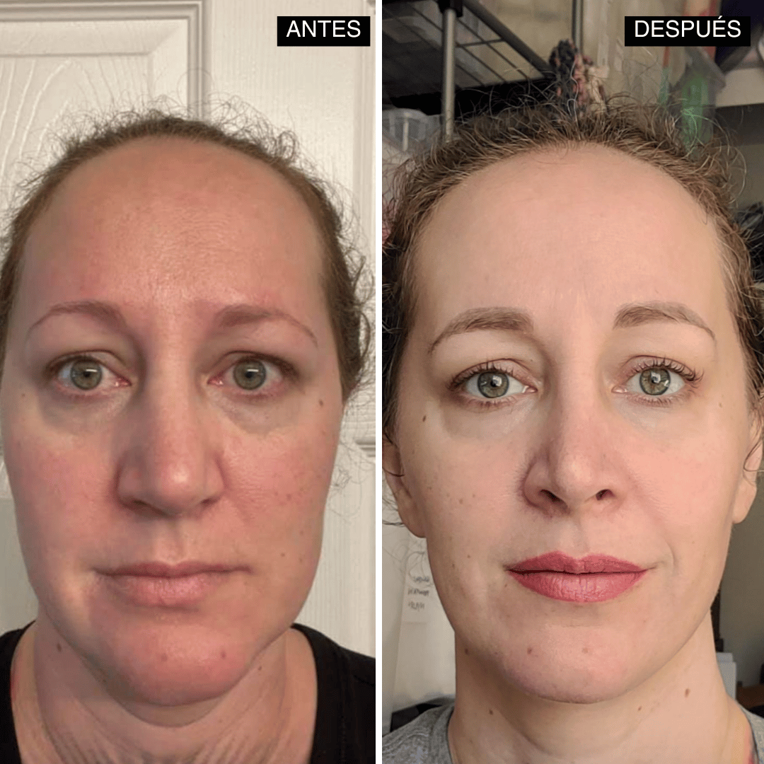 Velisse® Retinal Shot - Adiós Arrugas