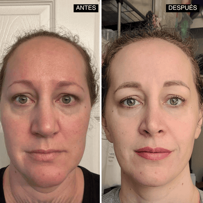 Velisse® Retinal Shot - Adiós Arrugas