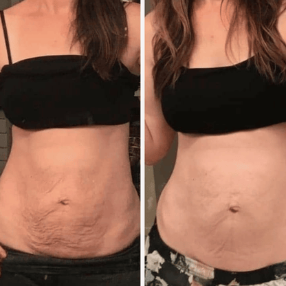 Velisse® Aceite Anti-Celulitis de Colágeno Hidrolizado