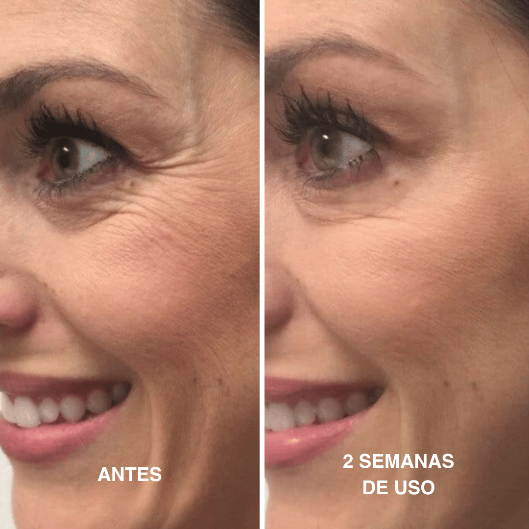 Velisse® Retinal Shot - Adiós Arrugas