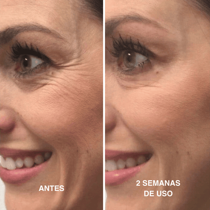 Velisse® Retinal Shot - Adiós Arrugas