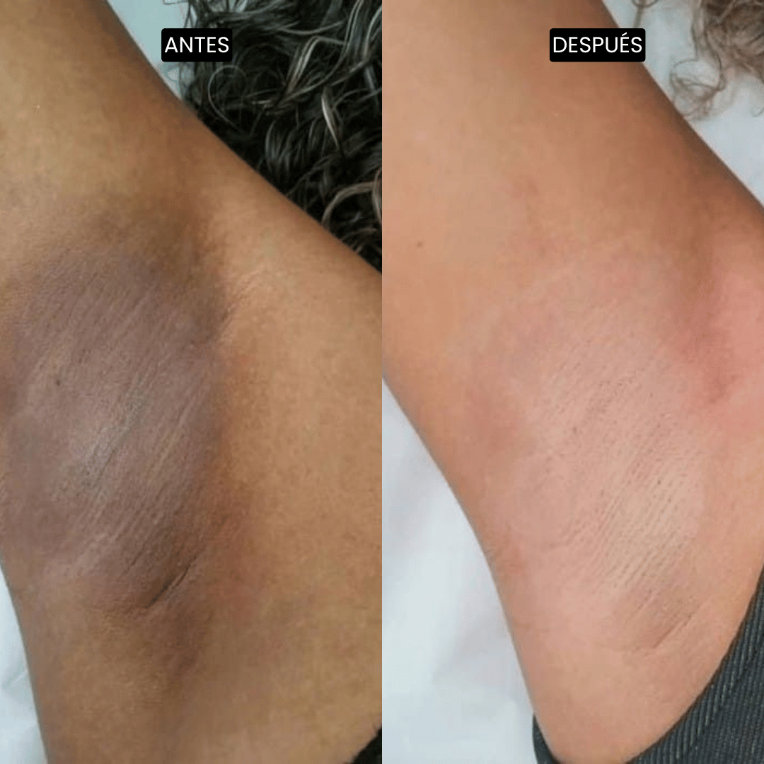 Velisse Piel Perfecta Shot - Spray exfoliante corporal con kójico y cúrcuma