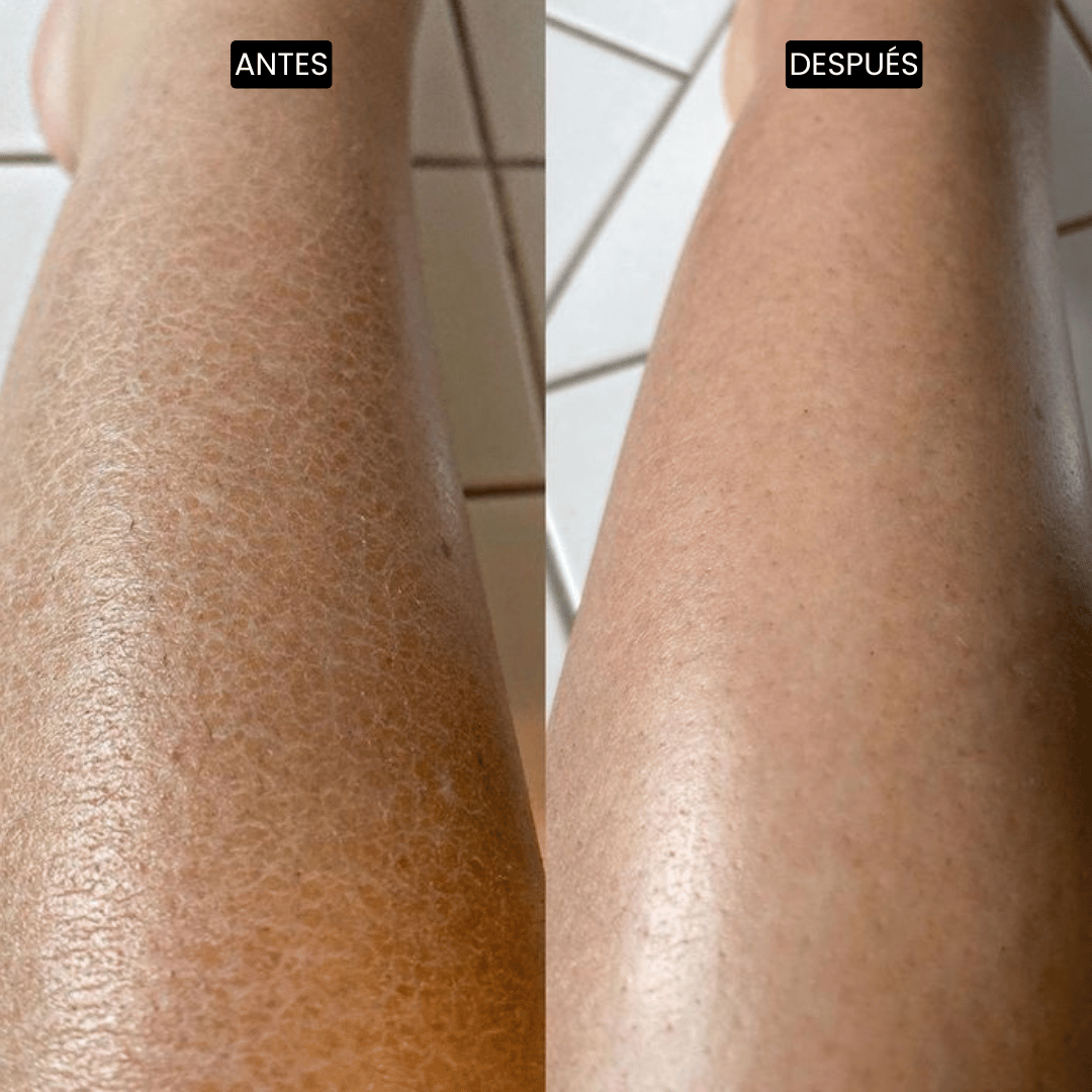 Velisse Piel Perfecta Shot - Spray exfoliante corporal con kójico y cúrcuma