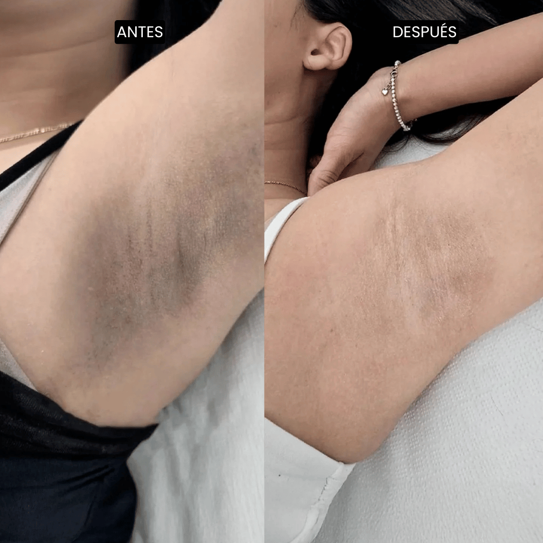Velisse Piel Perfecta Shot - Spray exfoliante corporal con kójico y cúrcuma