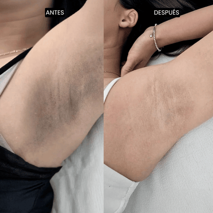 Velisse Piel Perfecta Shot - Spray exfoliante corporal con kójico y cúrcuma