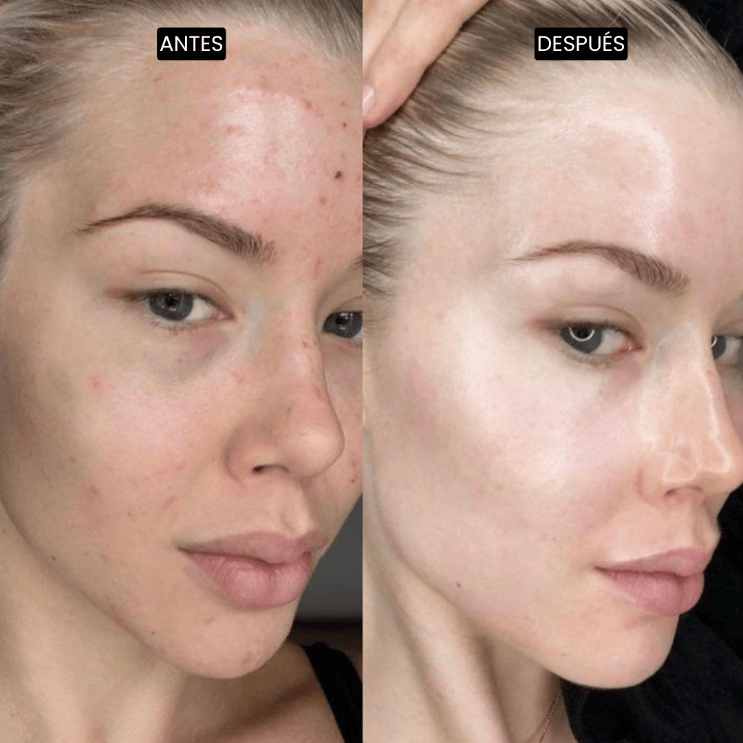 Velisse Piel Perfecta Shot - Spray exfoliante corporal con kójico y cúrcuma