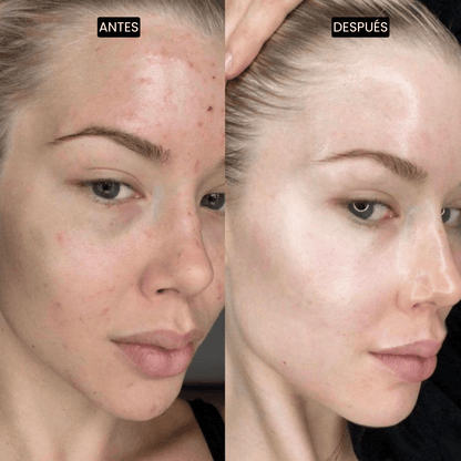 Velisse Piel Perfecta Shot - Spray exfoliante corporal con kójico y cúrcuma