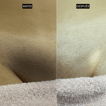 Velisse Piel Perfecta Shot - Spray exfoliante corporal con kójico y cúrcuma